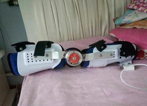 假肢矫形器价格解析与芜湖德康假肢矫形器服务介绍